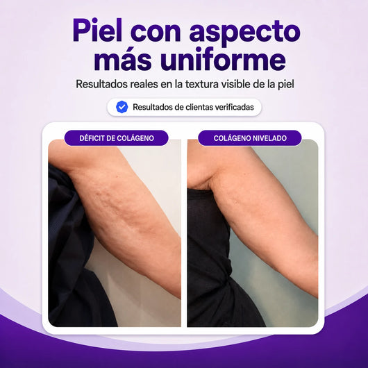 Colágeno Activo