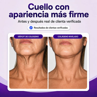 Colágeno Activo