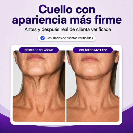 Colágeno Activo